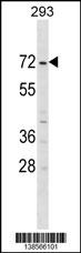 ZFP69B Antibody