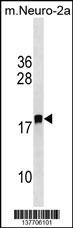 LDOC1L Antibody
