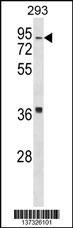 HIRIP3 Antibody
