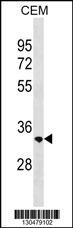 RAB40C Antibody