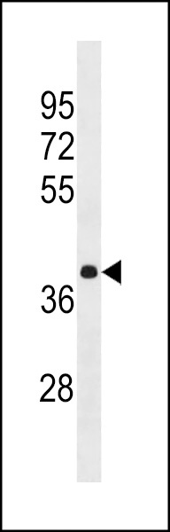 HNRNPA3 Antibody
