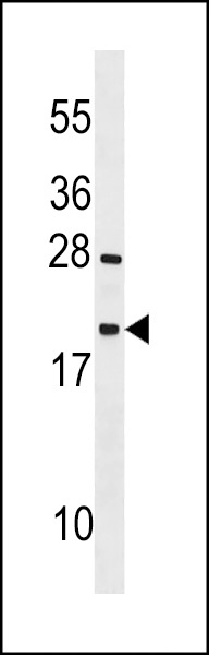 TEX12 Antibody