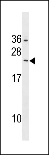 RAB5B Antibody