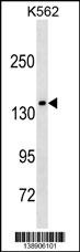 MLLT2 Antibody