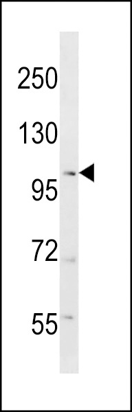 RANBP17 Antibody