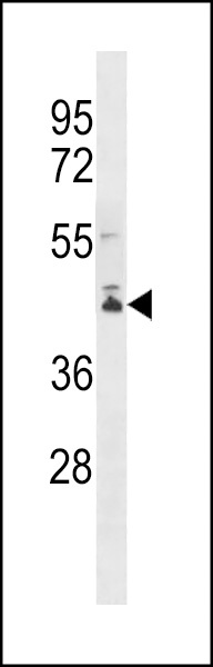PCMTD2 Antibody