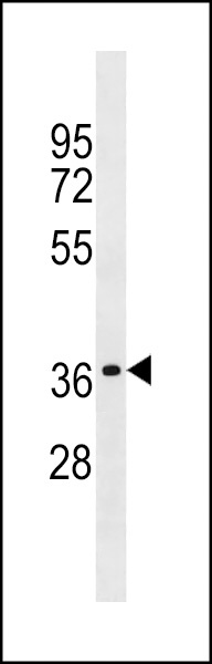 OR2W1 Antibody