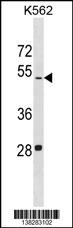 LDHAL6B Antibody