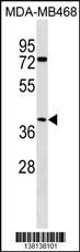 ABHD1 Antibody