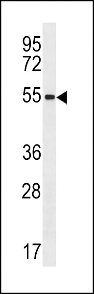 ZNF621 Antibody