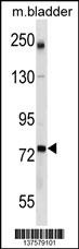 GCLC Antibody