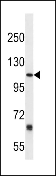 PTGFRN Antibody