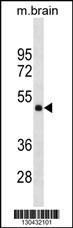 HMBOX1 Antibody