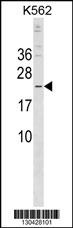 CRYBB3 Antibody