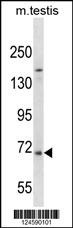 EXTL1 Antibody