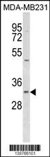 FAHD2B Antibody