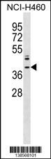 ZNF75A Antibody