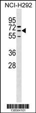 ZNF599 Antibody