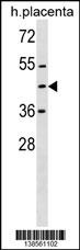 ZNF558 Antibody