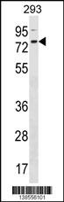 ZNF416 Antibody
