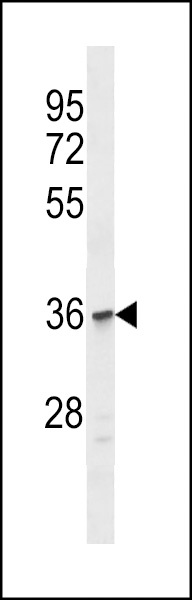 OR1C1 Antibody