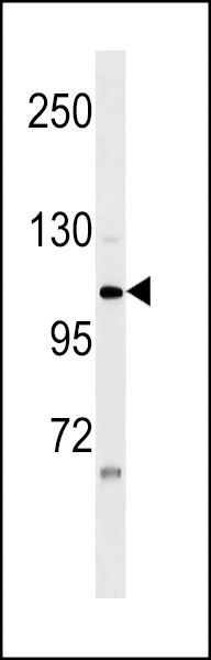 ZNF33A Antibody