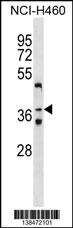 ZNF691 Antibody