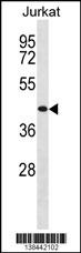 TRHR Antibody