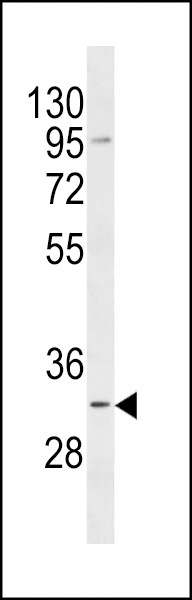 TACO1 Antibody