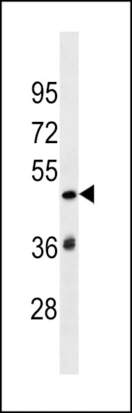SP140L Antibody
