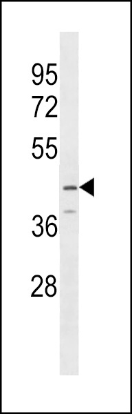 SERPINB12 Antibody