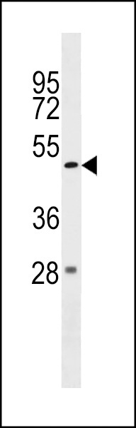 ZBTB47 Antibody