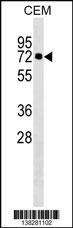 KLHL28 Antibody