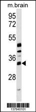 METTL6 Antibody