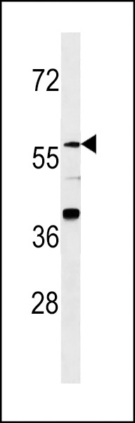 ZNF776 Antibody