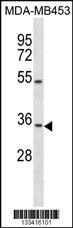 OSTM1 Antibody