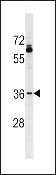 OR51T1 Antibody