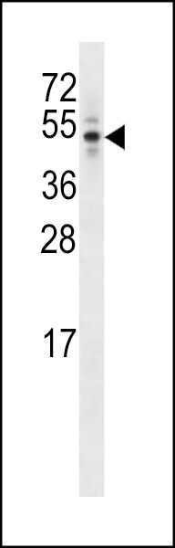 CEP44 Antibody
