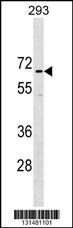 CCDC151 Antibody