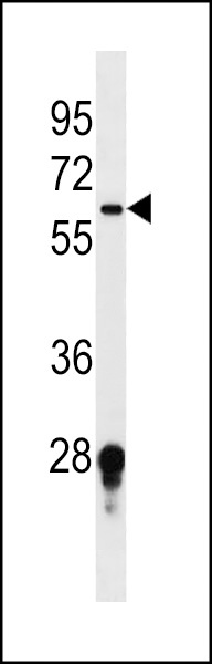 FUT11 Antibody