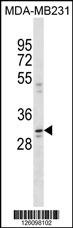 CCDC28A Antibody