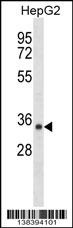 SDR39U1 Antibody