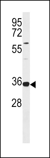 TRNAU1AP Antibody