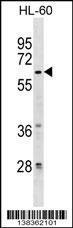 ZNF317 Antibody