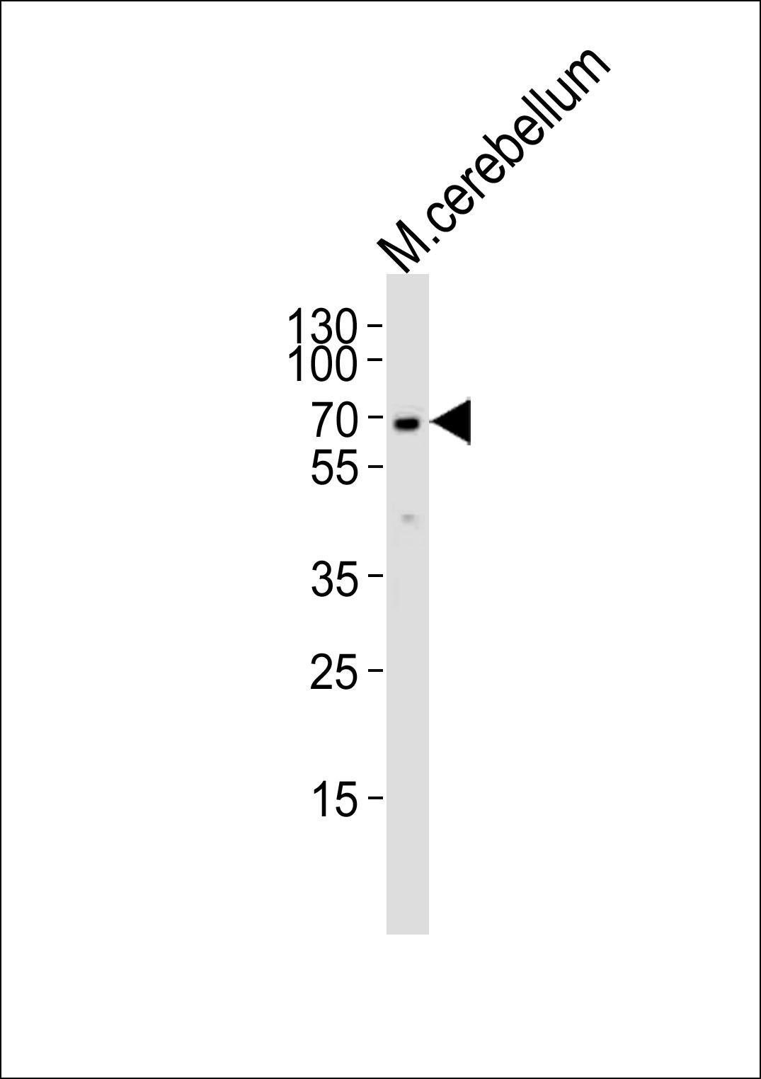 MTF2 Antibody