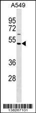 HAUS8 Antibody