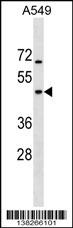 GTPBP5 Antibody