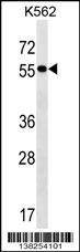 FRMD8 Antibody