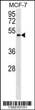 ENPP5 Antibody