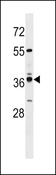 VN1R4 Antibody